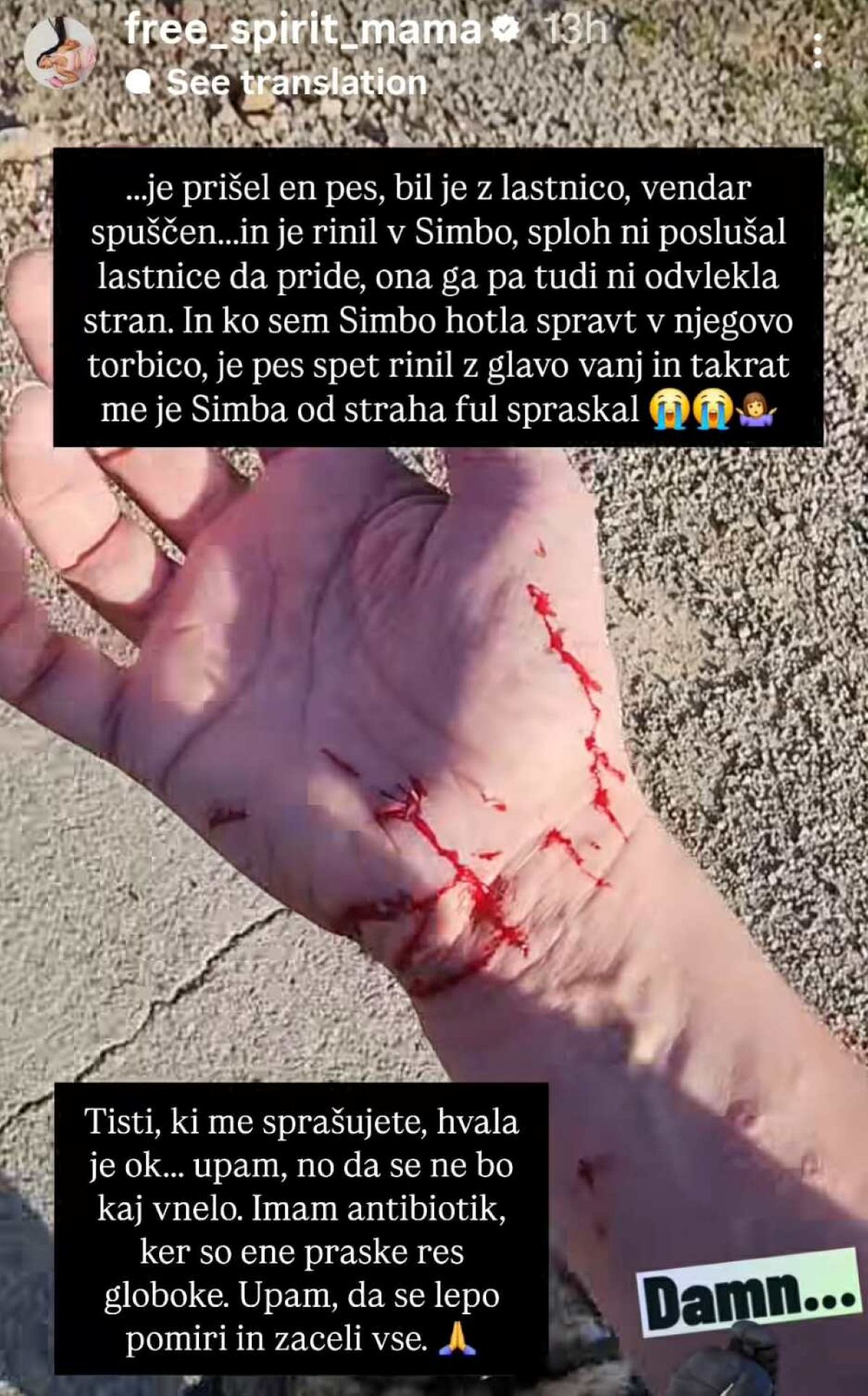 nesreča, praske, Instagram, Iris Mulej, 