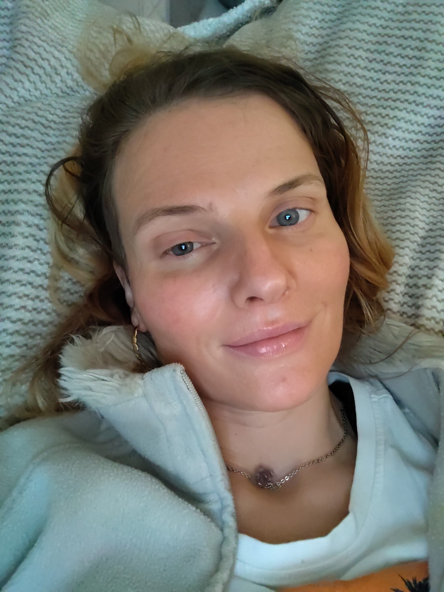 pevka Eva po nesreči